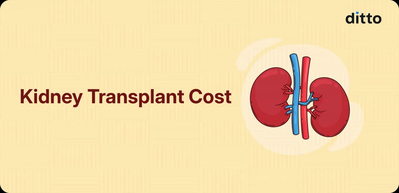 Kidney Transplant Cost: Complete Guide