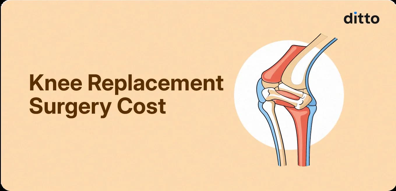Knee Replacement Surgery Cost